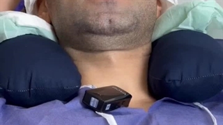 رضایت مراجعه کننده عزیز از کاشت موی طبیعی رنسانس