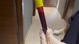 پی ار پی و مزوتراپی در کلینیک تخصصی آفتاب اصفهان 09133691289