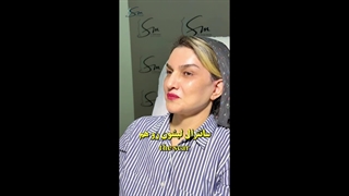 سوپر لیفت صورت و گردن، سانترال لب، لیفت اندوسکوپی ابرو و بلفاروپلاستی فوقانی