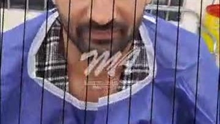 کاشت مو مهسا الوندی در مشهد