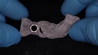 مراحل ایمپلنت دندان