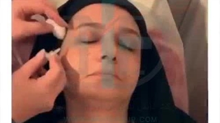 کربوکسی تراپی در کلینیک دکتر فروزش ( پارت 2 )