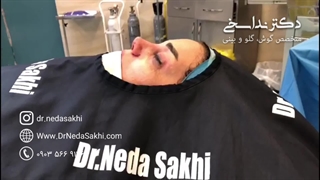 بلافاصله بعد از عمل بینی