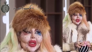 این زن ایرانی رکورددار عمل جراحی زیبایی در گینس است