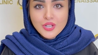 نتیجه کاشت ابرو بعد از 6 سال در کلینیک سینا