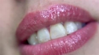 خدمات فیبروز و میکروبلیدینگ ابتسام مچری در شاهین شهر اصفهان