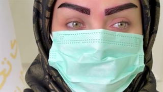 کاشت ابرو میکرو sut در کلینیک زیبایی رنسانس