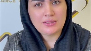 نتیجه کاشت ابرو بعد از 2 هفته در کلینیک زیبایی سینا ( رنسانس )