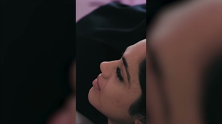 مراحل تزریق فیلر لب در کلینیک نوین ایرانا