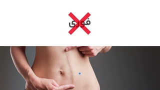 بهترین روش برای از بین بردن جای زخم چیست؟